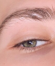 foreskin