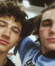 Xlamelo