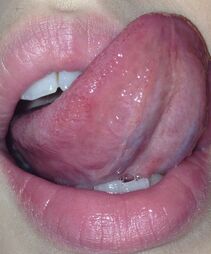 OralPerformer