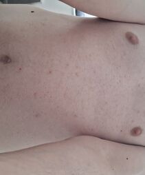 Skinnyshowoff