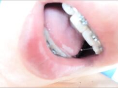 Latino ❤️ braces CumEater