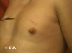 Danger Extrem !!! Screaming Guy Was Sewn *Nicer*