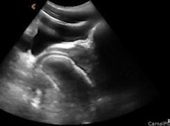 ♥ The infamous ultrasound machine ♥